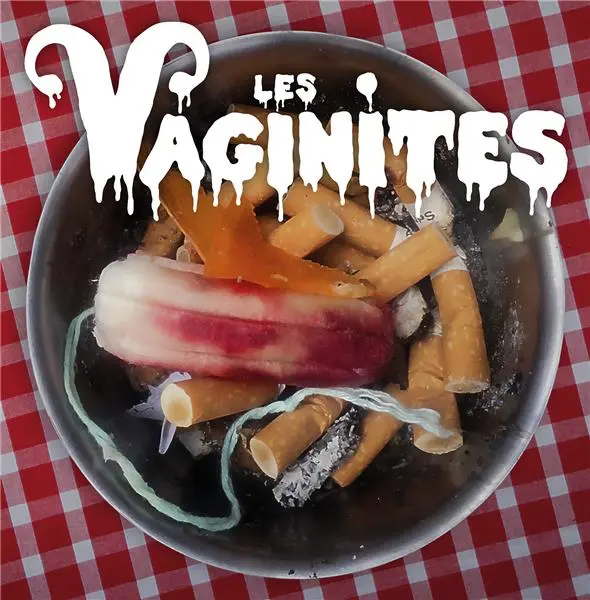 Les Vaginites