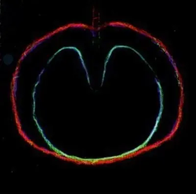 Wasp Star Apple Venus Volume 2